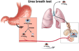 urea-breath-test